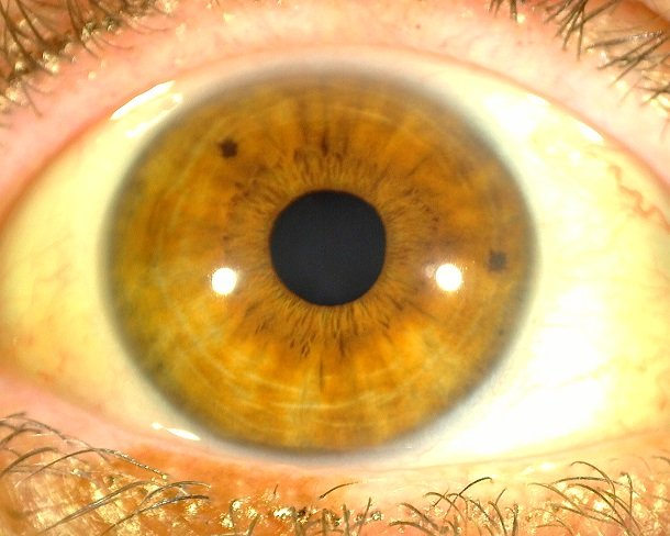auge